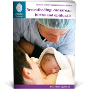 caesarean births and epidurals